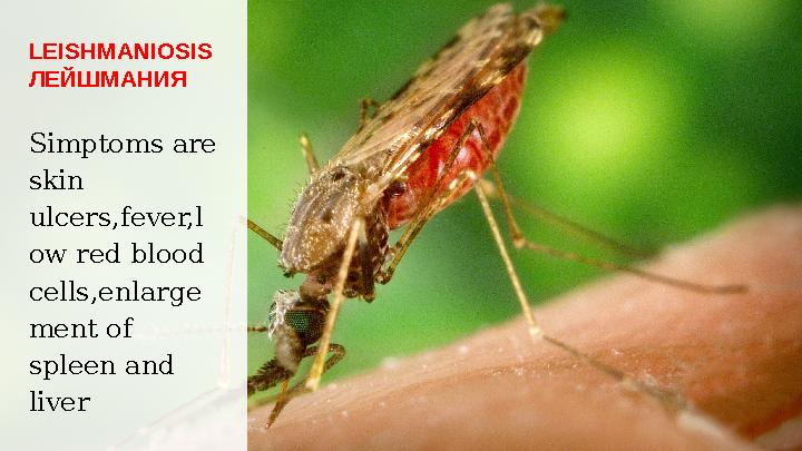LEISHMANIOSIS ЛЕЙШМАНИЯ Simptoms are skin ulcers,fever,l ow red blood cells,enlarge ment of spleen and liver