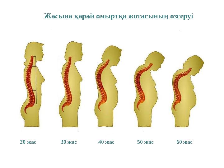 Жасына қарай омыртқа жотасының өзгеруі 20 жас 30 жас 40 жас 50 жас