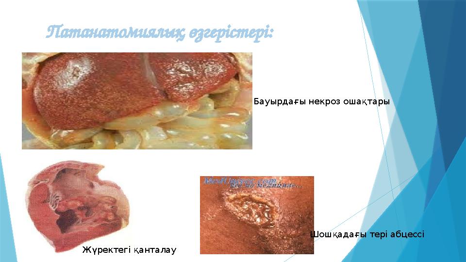 Патанатомиялық өзгерістері: Жүректегі қанталау Бауырдағы некроз ошақтары Шошқадағы тері абцессі