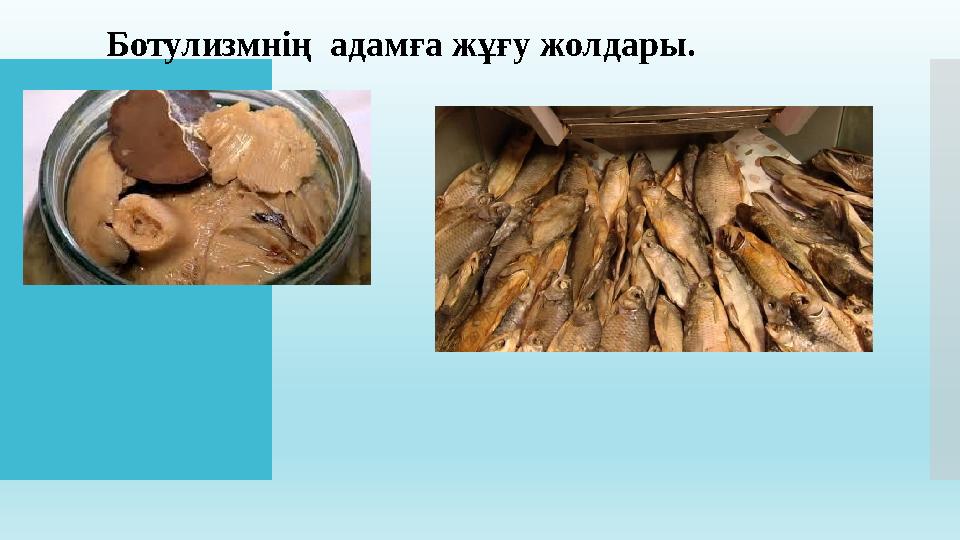 Ботулизмнің адамға жұғу жолдары.