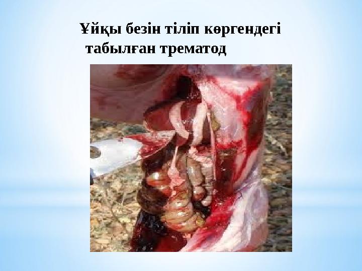 Ұйқы безін тіліп көргендегі табылған трематод