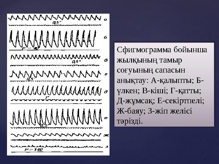 Сфигмограмма бойынша жылқының тамыр соғуының сапасын анықтау: А - қалыпты; Б - үлкен; В - кіші; Г - қатты; Д - жұмсақ; Е - с