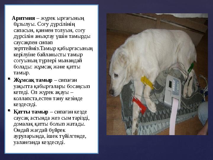 Аритмия – жүрек ырғағының бұзылуы. Соғу дүрсілінің сапасын, қанмен толуын, соғу дүрсілін анықтау үшін тамырды саусақпен