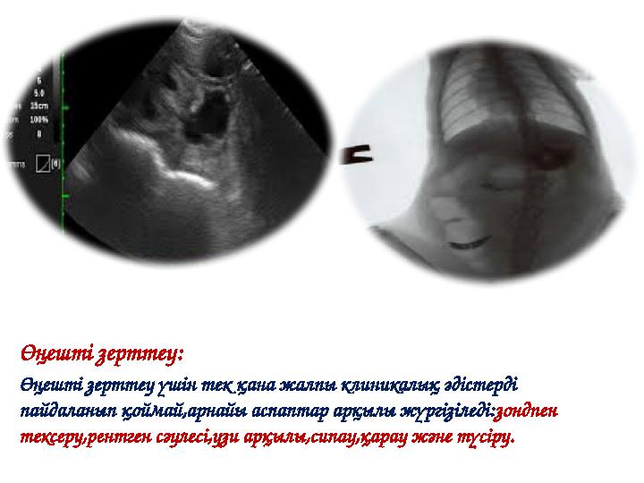 Өңешті зерттеу: Өңешті зерттеу үшін тек қана жалпы клиникалық әдістерді пайдаланып қоймай,арнайы аспаптар арқылы жүргізіледі: з