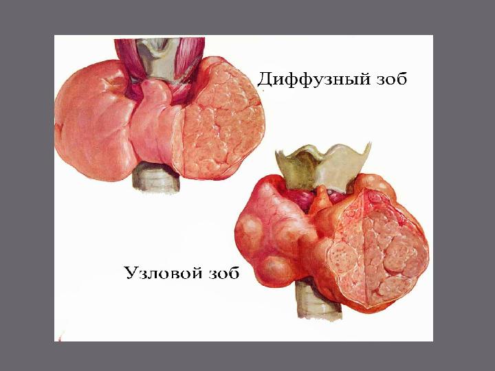  У взрослого крупного рогатого скота щитовидная железа увеличивается незначительно. Пальпация щитовидной железы затруднена в