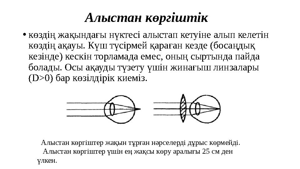 Алыстан көргіштік • көздің жақындағы нүктесі алыстап кетуіне алып келетін көздің ақауы. Күш түсірмей қараған кезде (босаңдық