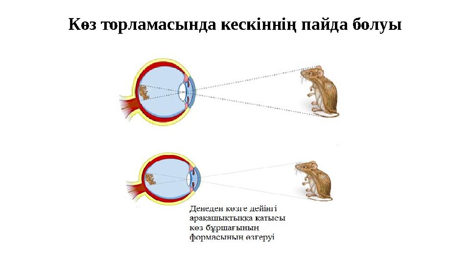 Көз торламасында кескіннің пайда болуы