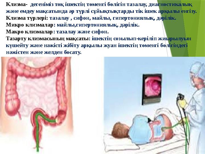 Киевтегі арзан қарт жезөкшелер