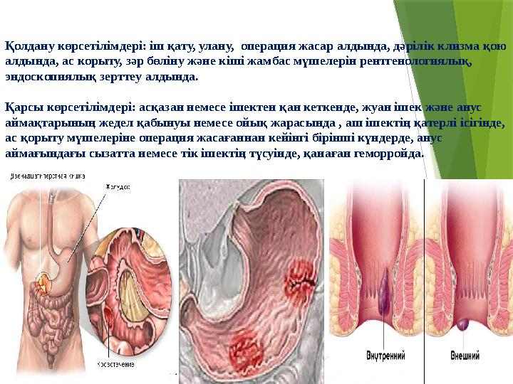 Қолдану көрсетілімдері: іш қату, улану, операция жасар алдында, дәрілік клизма қою алдында, ас корыту, зәр бөліну және кіші жа