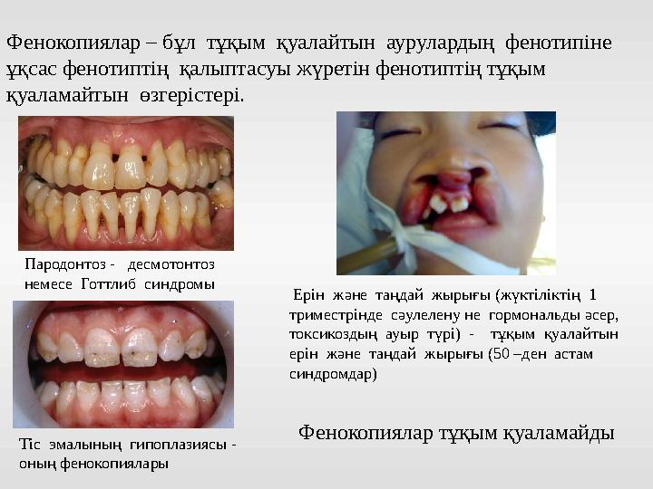Фенокопиялар – бұл тұқым қуалайтын аурулардың фенотипіне ұқсас фенотиптің қалыптасуы жүретін фенотиптің тұқым қуаламайт