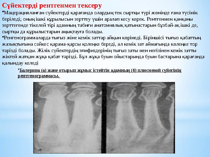 Сүйектерді рентгенмен тексеру • Мацерацияланған сүйектерді қарағанда олардың тек сыртқы түрі жөнінде ғана түсінік беріледі; оны