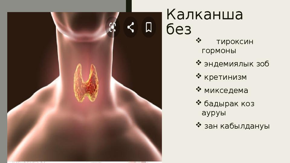 Ка лканша без  тирок с и н г о р м о н ы  э н д е м и я л ы к з об  кретинизм  миксе д е м а  бад