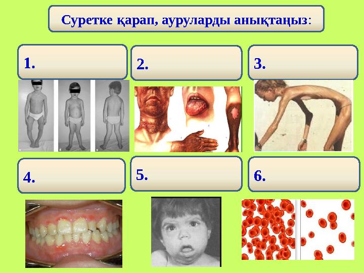 Суретке қарап, ауруларды анықтаңыз : 1. 3. 4. 5. 2. 6.