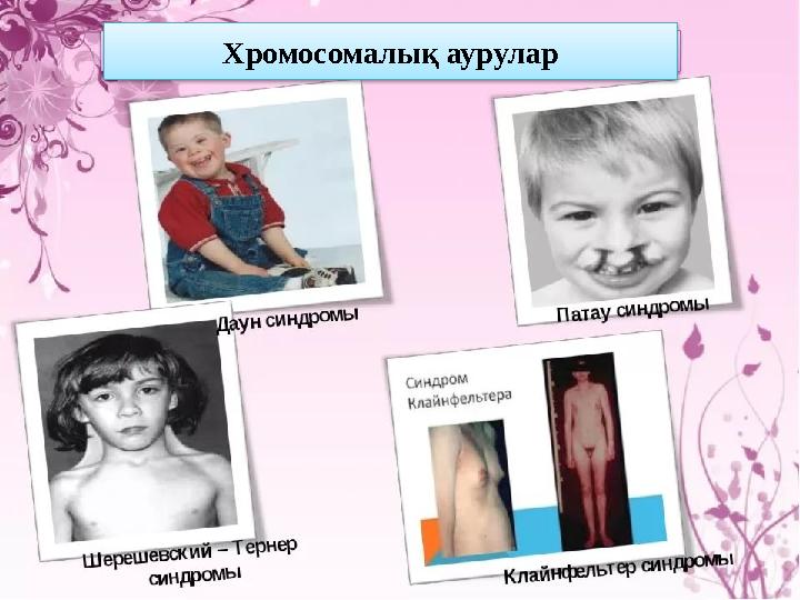 Хромосомалық аурулар