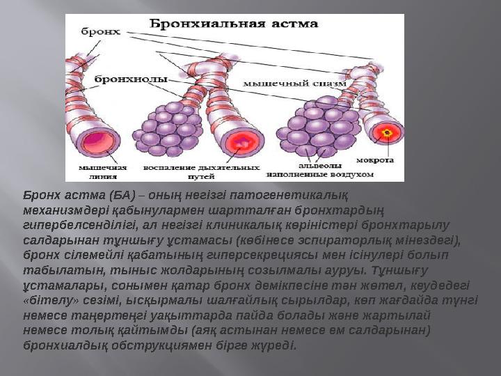 Бронх астма (БА) – оның негізгі патогенетикалық механизмдері қабынулармен шартталған бронхтардың гипербелсенділігі, ал нег
