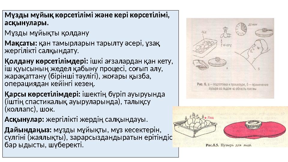 Мұзды мұйық көрсетілімі және кері көрсетілімі, асқынулары. Мұзды мұйықты қолдану Мақсаты: қан тамырларын тарылту әсері, ұзақ