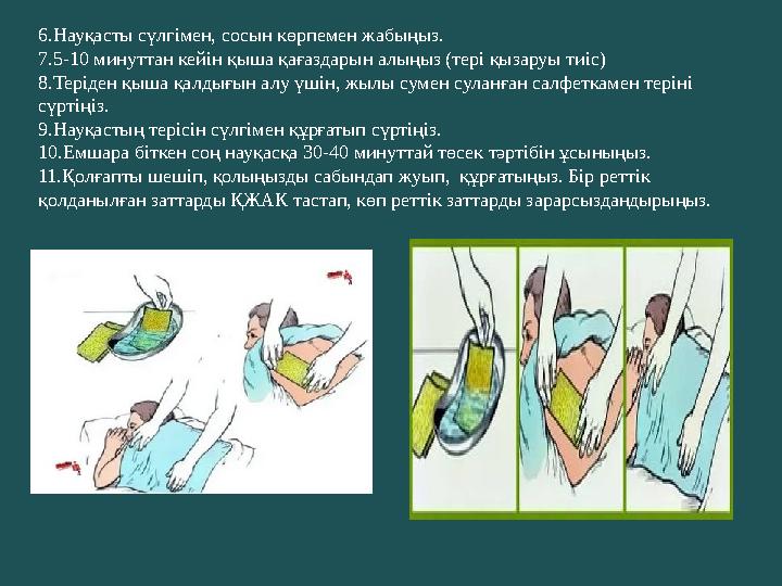 6.Науқасты сүлгімен, сосын көрпемен жабыңыз. 7.5-10 минуттан кейін қыша қағаздарын алыңыз (тері қызаруы тиіс) 8.Теріден қыша қал
