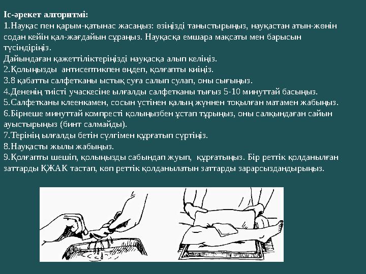 Іс-әрекет алгоритмі: 1.Науқас пен қарым-қатынас жасаңыз: өзіңізді таныстырыңыз, науқастан атын-жөнін содан кейін қал-жағдайын с