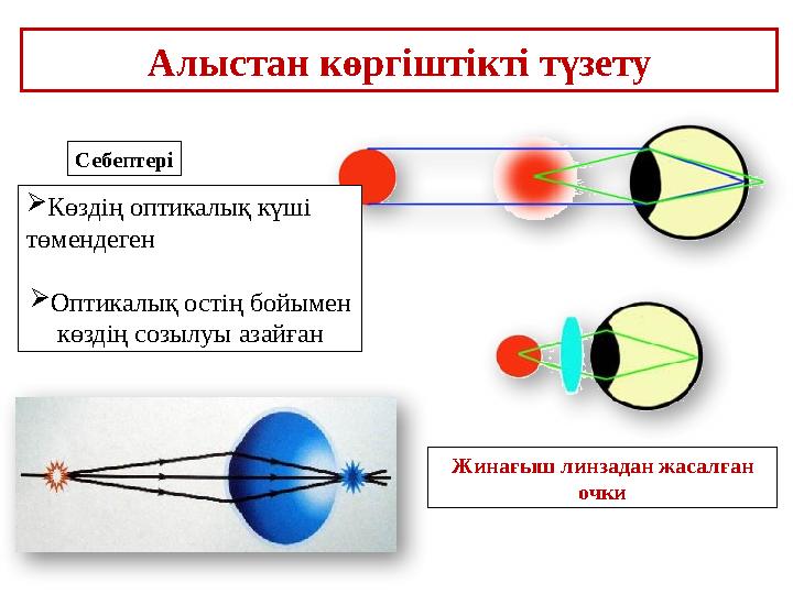 Жинағыш линзадан жасалған очкиАлыстан көргіштікті түзету Себептері  Көздің оптикалық күші төмендеген  Оптикалық остің бойыме