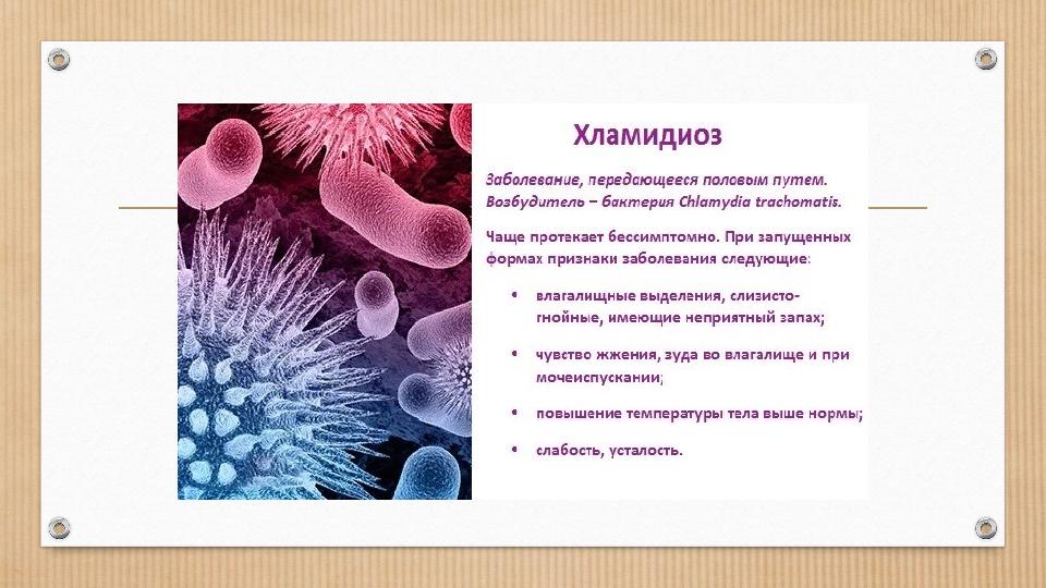 Қисық сұлулар секс