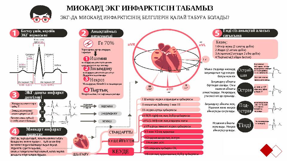 МИОКАРД ЭКГ ИНФАРКТІСІН ТАБАМЫЗ ЭКГ-ДА МИОКАРД ИНФАРКТІСІНІҢ БЕЛГІЛЕРІН ҚАЛАЙ ТАБУҒА БОЛАДЫ? Бастау үшін, көрейік ЭКГ нормас