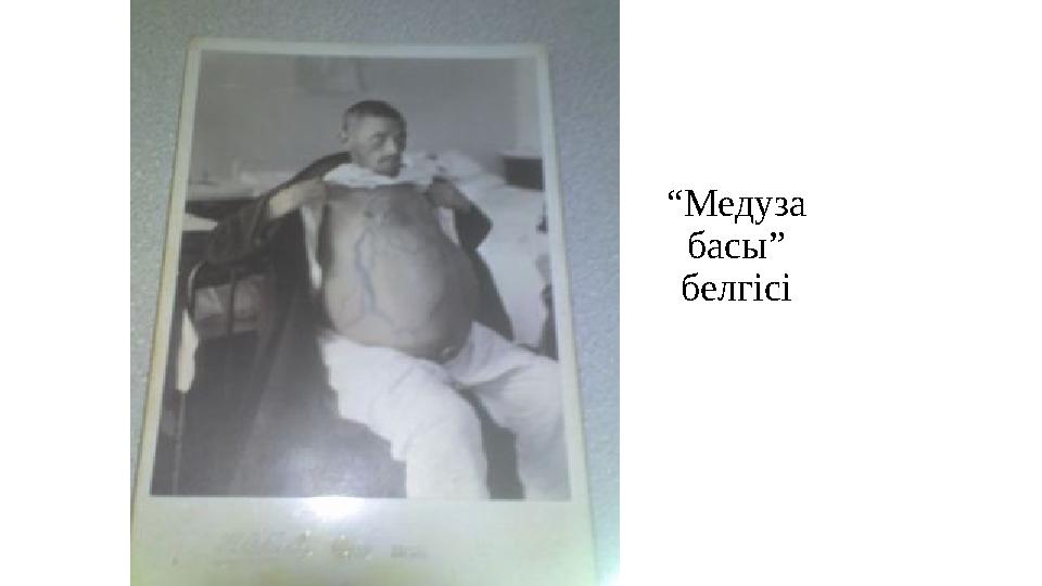 “ Медуза басы” белгісі