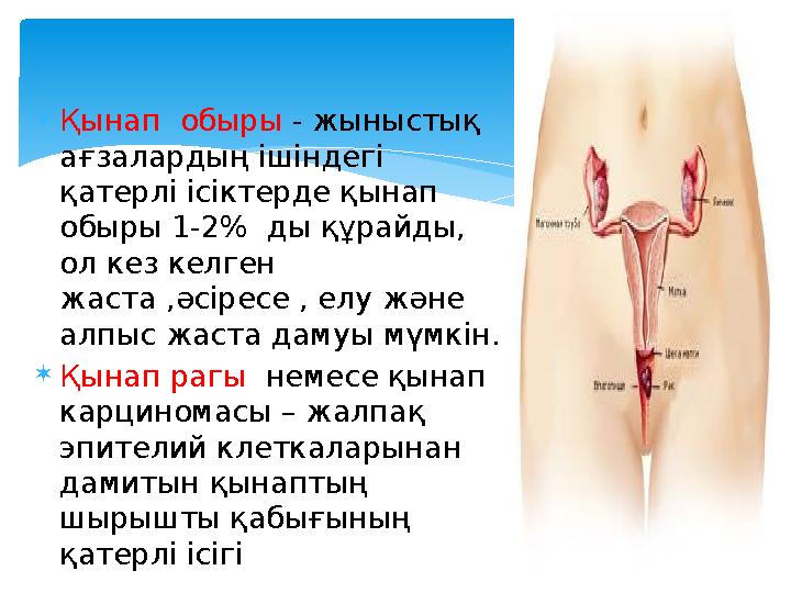  Қынап обыры - жыныстық ағзалардың ішіндегі қатерлі ісіктерде қынап обыры 1-2% ды құрайды, ол кез келген жаста ,әсір