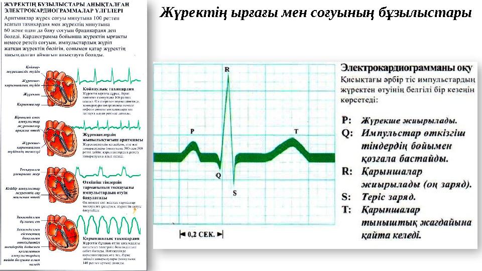 Ж үректің ырғағы мен соғуының бұзылыстары