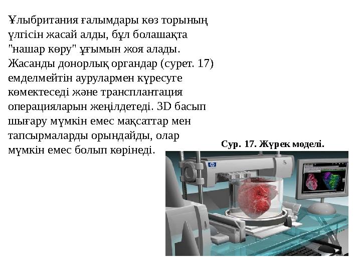 Ұлыбритания ғалымдары көз торының үлгісін жасай алды, бұл болашақта "нашар көру" ұғымын жоя алады. Жасанды донорлық органдар