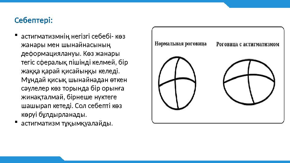 Себептері:  астигматизмнің негізгі себебі- көз жанары мен шынайнасының деформациялануы. Көз жанары тегіс сфералық пішінді ке