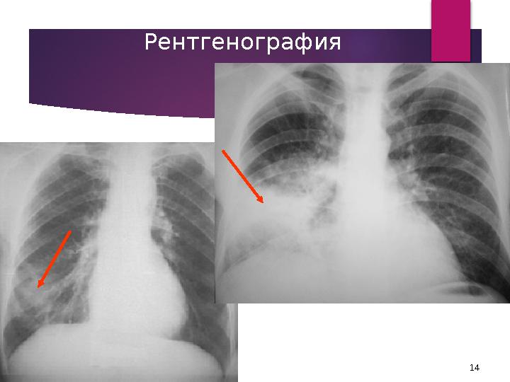 14Рентгенография