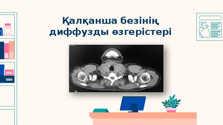 Қалқанша безінің диффузды өзгерістері