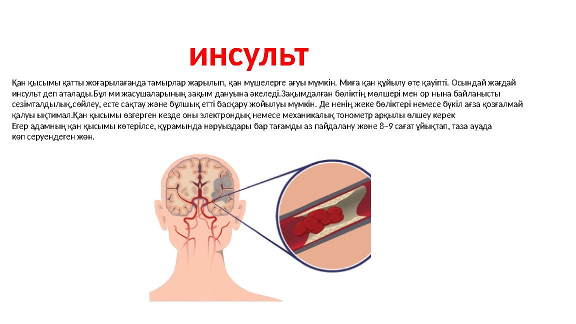 Қан қысымы қатты жоғарылағанда тамырлар жарылып, қан мүшелерге ағуы мүмкін. Миға ­ қан ­құйылу өте қауіпті. Осындай жағдай инсул
