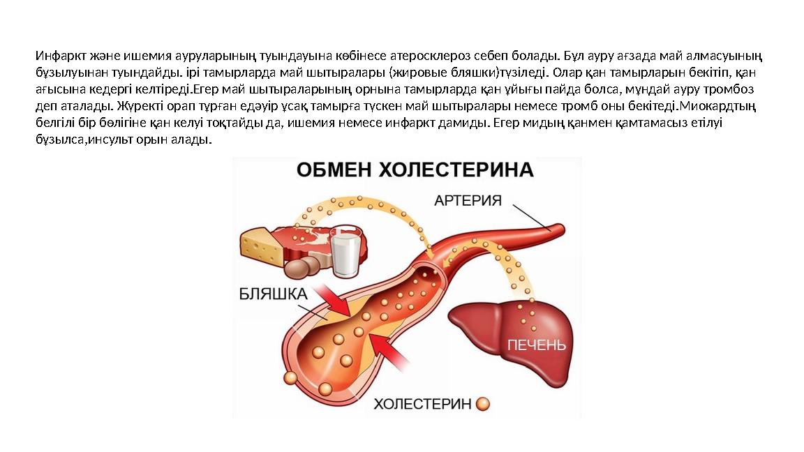 Инфаркт және ишемия ауруларының туындауына көбінесе атеросклероз себеп болады. Бұл ауру ағзада май алмасуының бұзылуынан туында