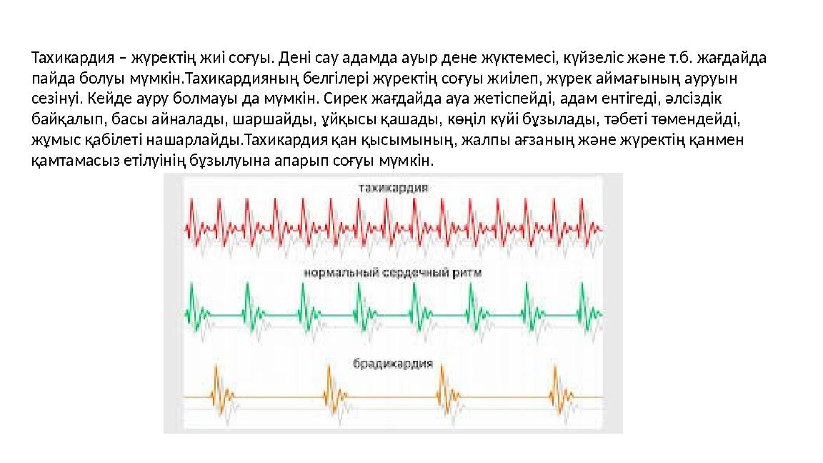 Тахикардия – жүректің жиі соғуы. Дені сау адамда ауыр дене жүктемесі, күйзеліс және т.б. жағдайда пайда болуы мүмкін.Тахикардия