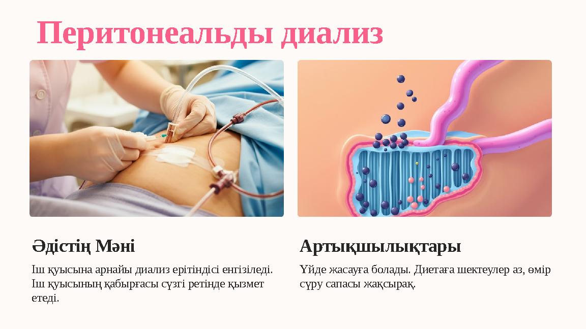Перитонеальды диализ Әдістің Мәні Іш қуысына арнайы диализ ерітіндісі енгізіледі. Іш қуысының қабырғасы сүзгі ретінде қызмет е