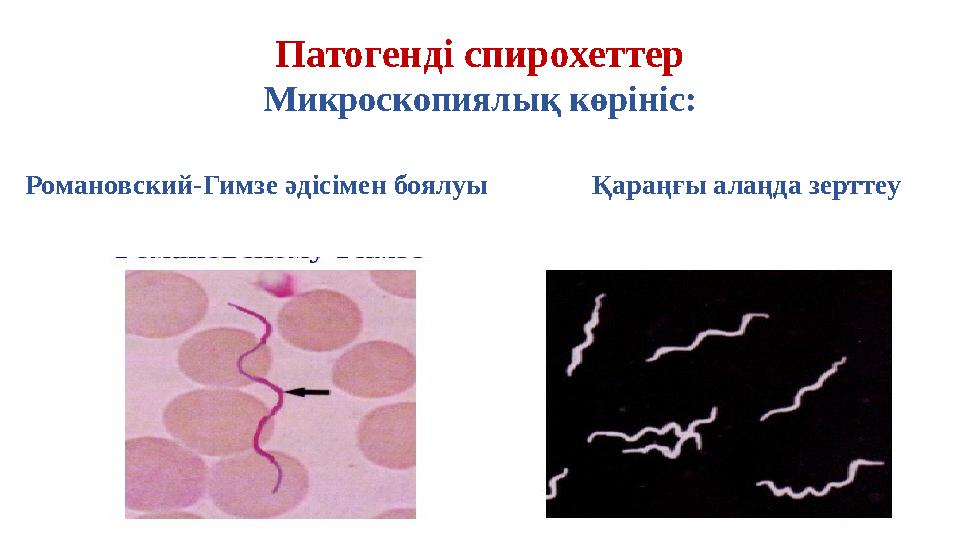 Патогенді спирохеттер Микроскопиялық көрініс: Романовский -Гимзе әдісімен боялуы Қараңғы алаңда зерттеу