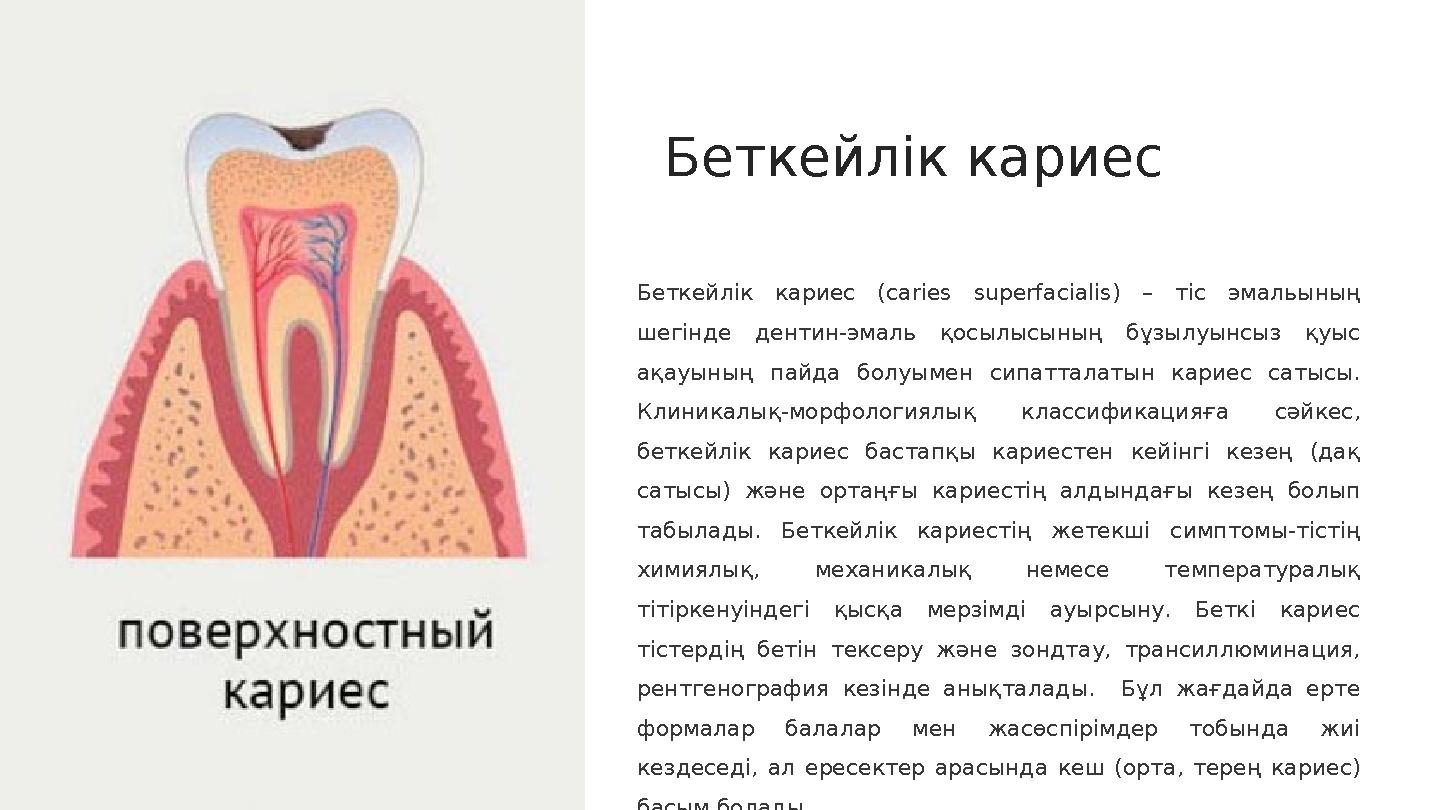 Беткейл ік кариес Беткейлік кариес ( caries superfacialis) – тіс эмальының шегінде дентин-эмаль қосылысының бұзылуынс