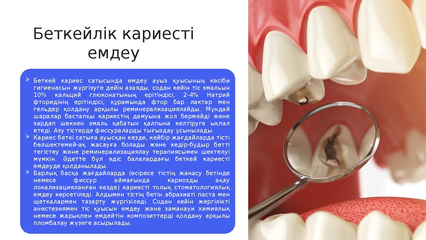  Беткей кариес сатысында емдеу ауыз қуысының кәсіби гигиенасын жүргізуге дейін азаяды, содан кейін тіс эмальын 1