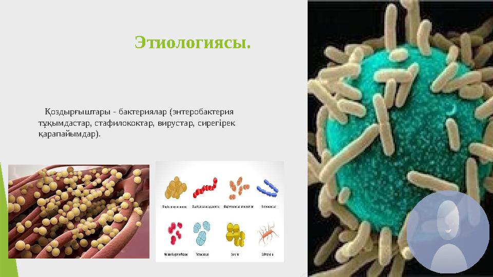 Этиологиясы. Қоздырғыштары - бактериялар (энтеробактерия тұқымдастар, стафилококтар, вирустар, сирегірек