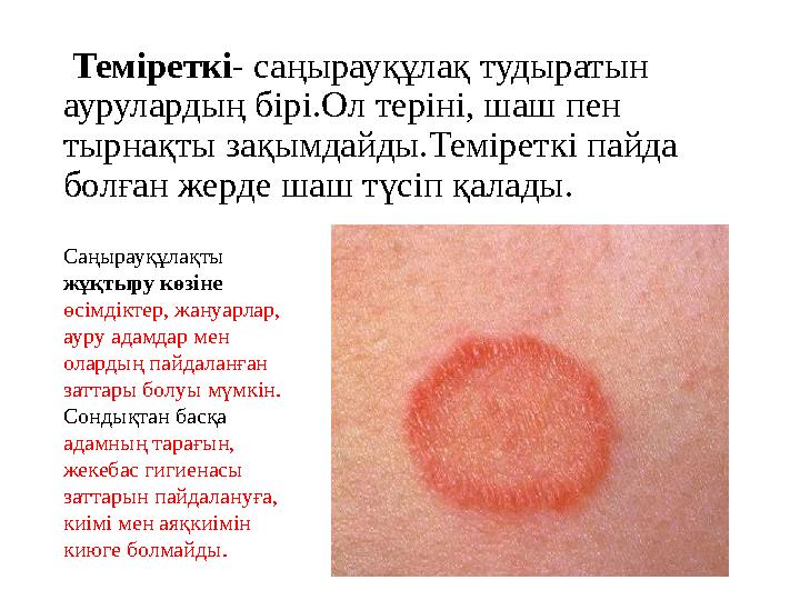 Теміреткі - саңырауқұлақ тудыратын аурулардың бірі.Ол теріні, шаш пен тырнақты зақымдайды.Теміреткі пайда болған жерде шаш