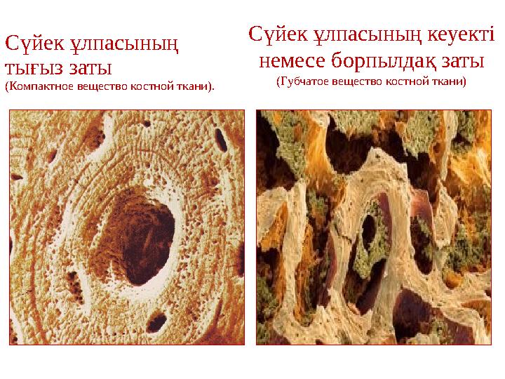 Дегенерация суставного хряща. Костная соединительная ткань. Жировая дегенерация позвонков на мрт что это. Дегенерация и регенерация нервных волокон. Костная ткань дегенерация.