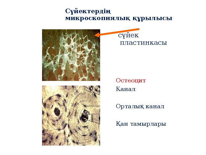 Сүйектердің микроскопиялық құрылысы сүйек пластинкасы Остеоцит Канал Орталық канал Қан тамырлары