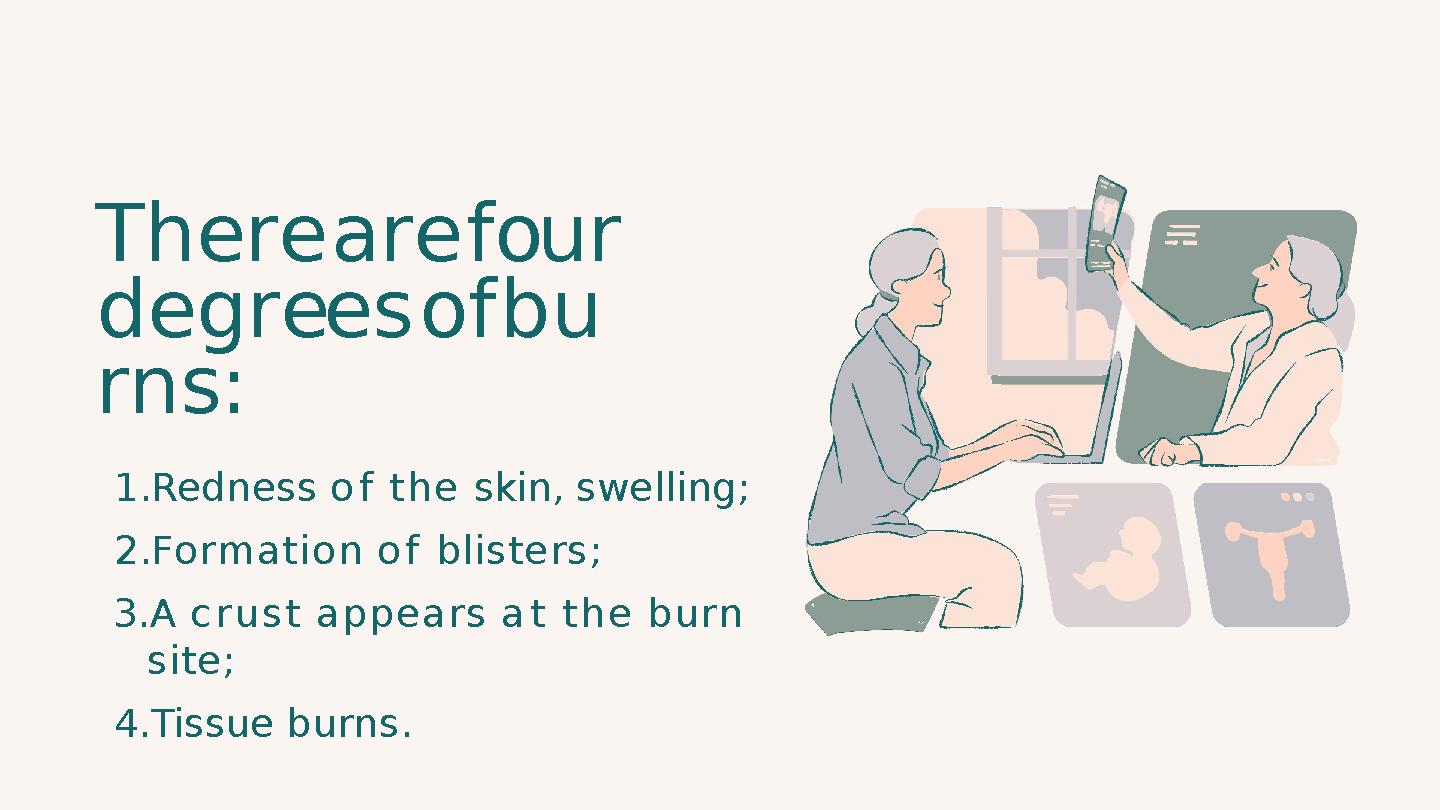 T h e r e a r e f ou r d e g r ee s o f b u r n s : 1. Redness o f t h e skin, swelling; 2. Formation o f blisters