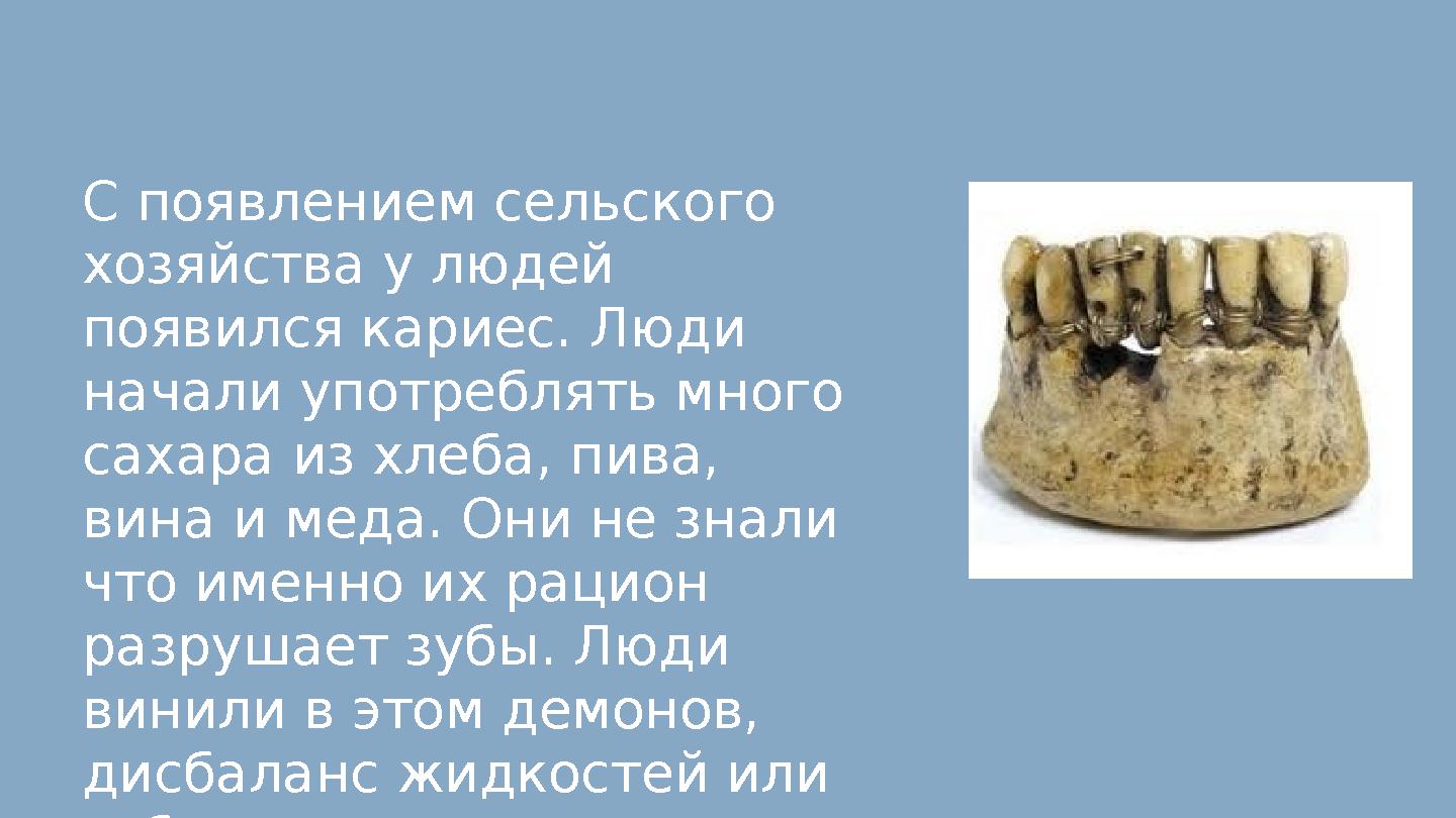 С появлением сельского хозяйства у людей появился кариес. Люди начали употреблять много сахара из хлеба, пива, вина и меда.