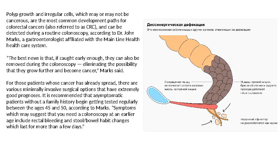 Polyp growth and irregular cells, which may or may not be cancerous, are the most common development paths for colorectal canc