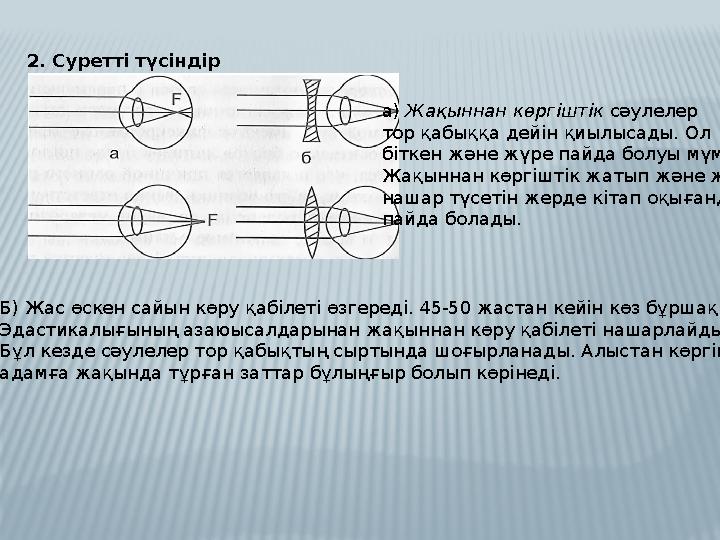 2. Суретті түсіндір а ) Жақыннан көргіштік сәулелер тор қабыққа дейін қиылысады. Ол біткен және жүре пайда болуы мүмкін. Жақы