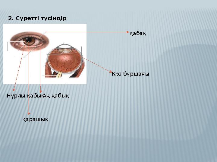 2. Суретті түсіндір қабақ Ақ қабық қарашықНұрлы қабық Көз бұршағы