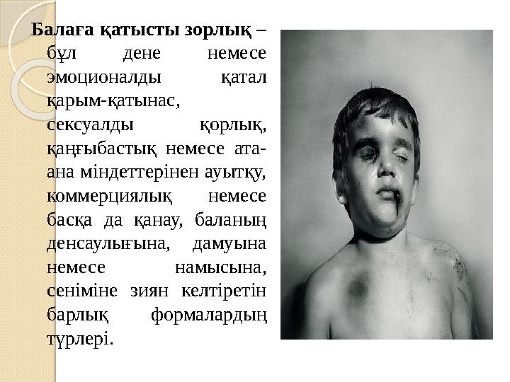 Балаға қатысты зорлық – бұл дене немесе эмоционалды қатал қарым-қатынас, сексуалды қорлық, қаңғыбастық немесе ата- ан