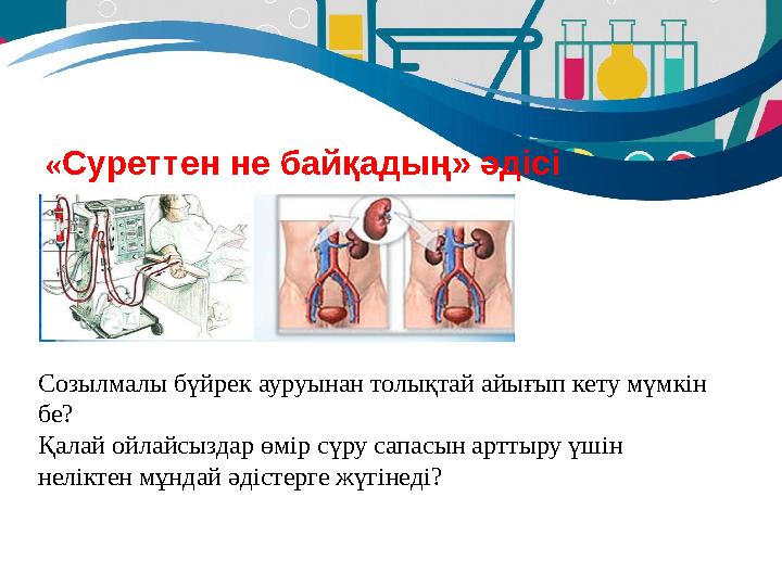 «Суреттен не байқадың» әдісі Созылмалы бүйрек ауруынан толықтай айығып кету мүмкін бе? Қалай ойлайсыздар өмір сүру сапасын артт